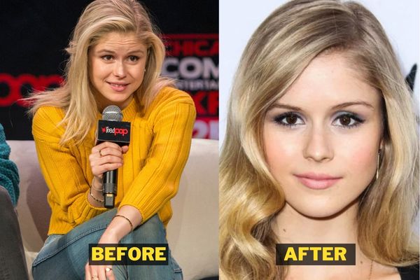 Erin moriarty plastic surgery is Real News